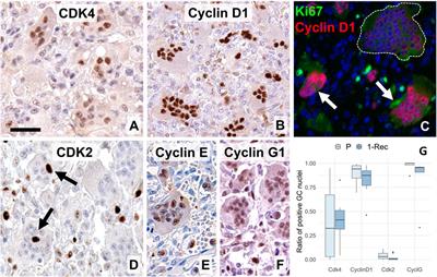 Cell Cycle Regulatory Protein Expression in Multinucleated Giant Cells of Giant Cell Tumor of Bone: do They Proliferate?